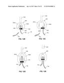 DEVICES FOR APPROXIMATING TISSUE AND RELATED METHODS OF USE diagram and image