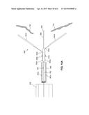 DEVICES FOR APPROXIMATING TISSUE AND RELATED METHODS OF USE diagram and image