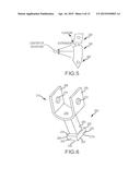 INTERSPINOUS SPACER DEVICES FOR DYNAMIC STABILIZATION OF DEGRADED SPINAL     SEGMENTS diagram and image