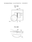 PROCESSING METHOD, PROGRAM, PROCESSING APPARATUS, AND DETECTION SYSTEM diagram and image