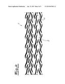 Loop-forming closure element for hook-and-loop fasteners and method for     the production of a closure element diagram and image