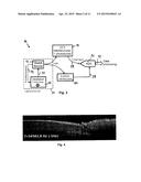 SWEPT SOURCE OCT SYSTEM AND METHOD WITH PHASE-LOCKED DETECTION diagram and image