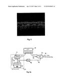 SWEPT SOURCE OCT SYSTEM AND METHOD WITH PHASE-LOCKED DETECTION diagram and image