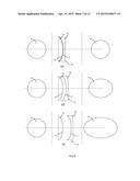 BEAM SHAPER diagram and image