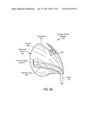 EARPHONE HAVING AN ACOUSTIC TUNING MECHANISM diagram and image