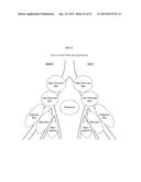 METHODS OF USING SPECT/CT ANALYSIS FOR STAGING CANCER diagram and image