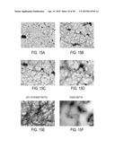 FILAMENTOUS BACTERIOPHAGE AS AN ANGIOGENESIS MODULATOR diagram and image