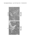 FILAMENTOUS BACTERIOPHAGE AS AN ANGIOGENESIS MODULATOR diagram and image