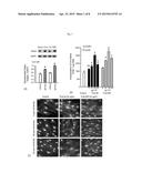 ELASTIN PRODUCING FIBROBLAST FORMULATIONS AND METHODS OF USING THE SAME diagram and image