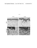 ELASTIN PRODUCING FIBROBLAST FORMULATIONS AND METHODS OF USING THE SAME diagram and image