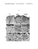 ELASTIN PRODUCING FIBROBLAST FORMULATIONS AND METHODS OF USING THE SAME diagram and image