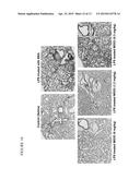 COMPOSITIONS COMPRISING MG53 AND METHODS FOR THE TREATMENT AND PREVENTION     OF AIRWAY INJURY diagram and image