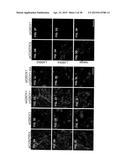 COMPOSITIONS FOR INHIBITION OF QUIESCIN SULFHYDRYL OXIDASE (QSOX1) AND     USES OF SAME diagram and image