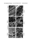 COMPOSITIONS FOR INHIBITION OF QUIESCIN SULFHYDRYL OXIDASE (QSOX1) AND     USES OF SAME diagram and image