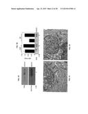 COMPOSITIONS FOR INHIBITION OF QUIESCIN SULFHYDRYL OXIDASE (QSOX1) AND     USES OF SAME diagram and image