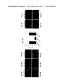 COMPOSITIONS FOR INHIBITION OF QUIESCIN SULFHYDRYL OXIDASE (QSOX1) AND     USES OF SAME diagram and image