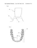 MODELING A DIGITAL DESIGN OF A DENTURE diagram and image