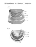 MODELING A DIGITAL DESIGN OF A DENTURE diagram and image