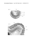 MODELING A DIGITAL DESIGN OF A DENTURE diagram and image