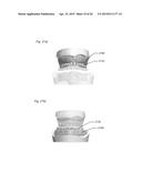 MODELING A DIGITAL DESIGN OF A DENTURE diagram and image