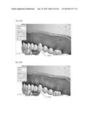 MODELING A DIGITAL DESIGN OF A DENTURE diagram and image