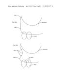 MODELING A DIGITAL DESIGN OF A DENTURE diagram and image