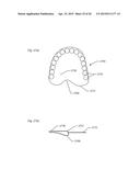 MODELING A DIGITAL DESIGN OF A DENTURE diagram and image