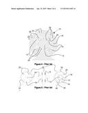 Planetary gear train for use with extended length sun in high torque     applications diagram and image