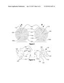 Planetary gear train for use with extended length sun in high torque     applications diagram and image