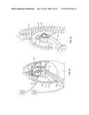 DIAPHRAGM ENTRY FOR POSTERIOR SURGICAL ACCESS diagram and image