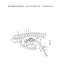 DIAPHRAGM ENTRY FOR POSTERIOR SURGICAL ACCESS diagram and image