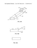 DIAPHRAGM ENTRY FOR POSTERIOR SURGICAL ACCESS diagram and image