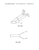 DIAPHRAGM ENTRY FOR POSTERIOR SURGICAL ACCESS diagram and image