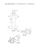 DIAPHRAGM ENTRY FOR POSTERIOR SURGICAL ACCESS diagram and image