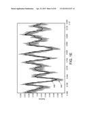 ARRHYTHMIA DETECTION diagram and image