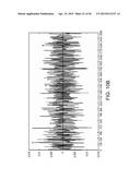 ARRHYTHMIA DETECTION diagram and image