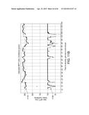 ARRHYTHMIA DETECTION diagram and image