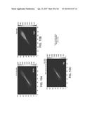 ARRHYTHMIA DETECTION diagram and image