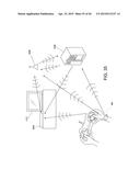 ARRHYTHMIA DETECTION diagram and image