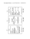 ARRHYTHMIA DETECTION diagram and image