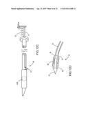 SYSTEMS AND METHODS FOR MONITORING ENDOLUMINAL VALVE FORMATION diagram and image