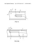 SYSTEMS AND METHODS FOR MONITORING ENDOLUMINAL VALVE FORMATION diagram and image