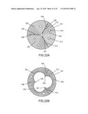 SYSTEMS AND METHODS FOR MONITORING ENDOLUMINAL VALVE FORMATION diagram and image