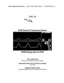 TRANSDUCER INTERFACE SYSTEM AND METHOD diagram and image