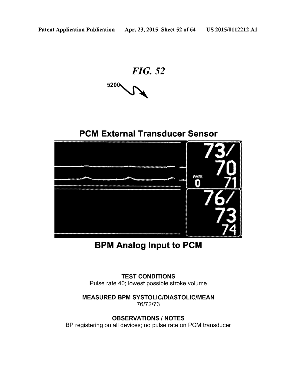 TRANSDUCER INTERFACE SYSTEM AND METHOD - diagram, schematic, and image 53