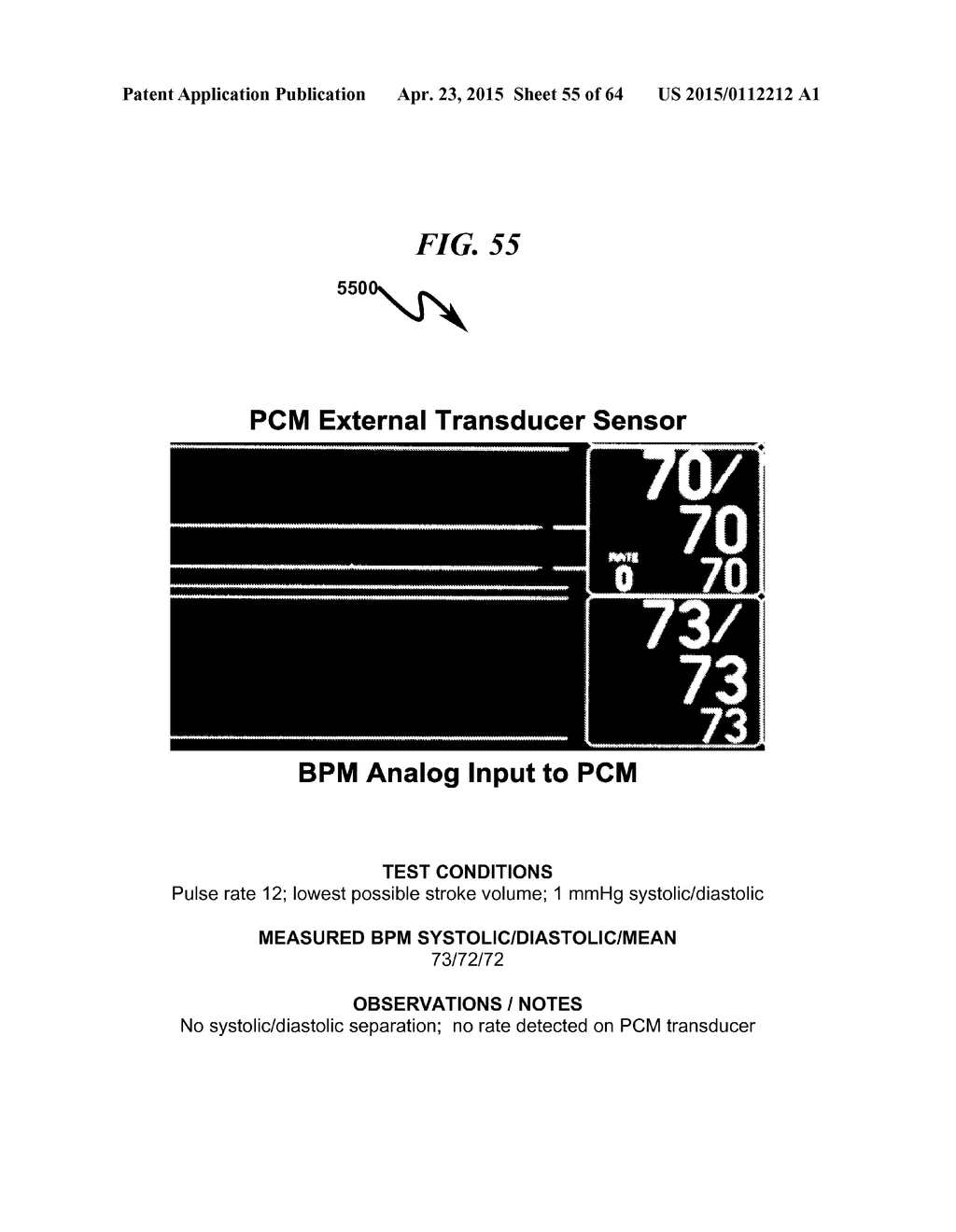 TRANSDUCER INTERFACE SYSTEM AND METHOD - diagram, schematic, and image 56