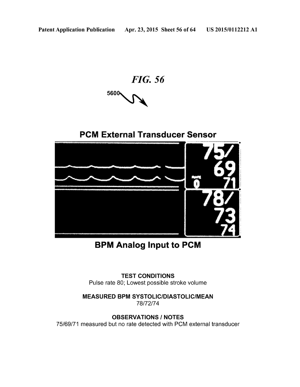 TRANSDUCER INTERFACE SYSTEM AND METHOD - diagram, schematic, and image 57