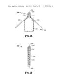 Fluid Delivery Device diagram and image