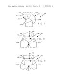 DISPOSABLE ABSORBENT ARTICLE HAVING BREATHABLE SIDE FLAPS diagram and image