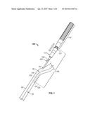 ANCHORING AN INTRAVENOUS CANNULA diagram and image